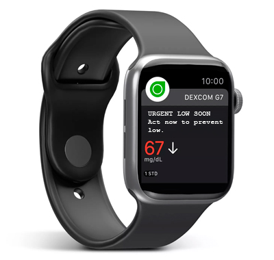 Imagen de la aplicación Dexcom G7 Watch para iOS en un reloj inteligente