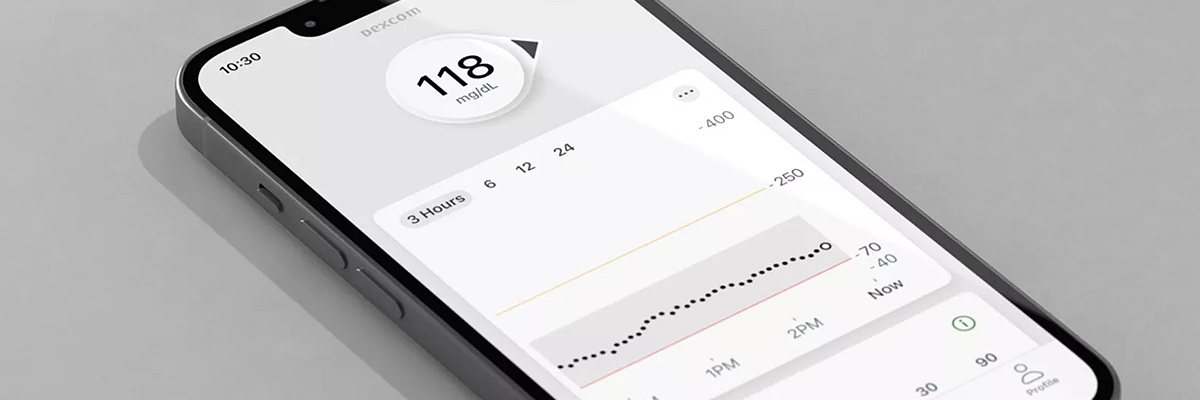 La AEMPS informa de un posible fallo en la actualización de los valores estimados de glucosa en la aplicación Dexcom G7 iOS