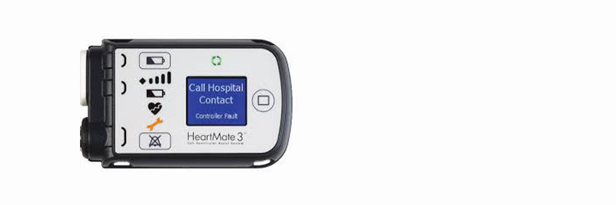 Alarma de fallo de la batería de respaldo en HeartMate 3