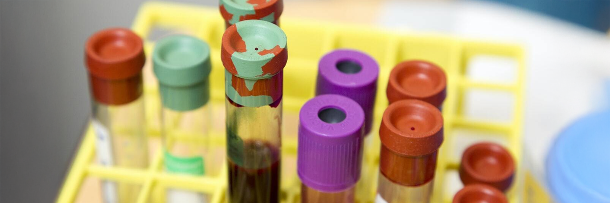 La EMA certifica por primera vez plasma procedente de África y Oriente Medio para fabricar hemoderivados en la UE