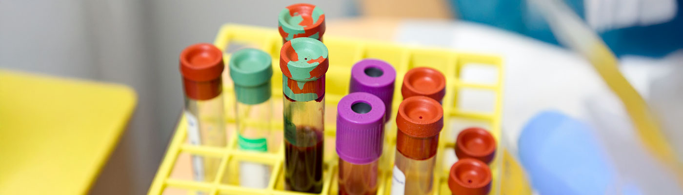 Imagen de plasma en tubos